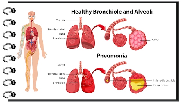 Vector gratuito saludables y no saludables de los pulmones humanos.