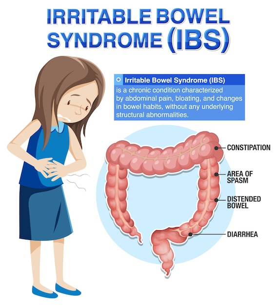 Vector gratuito síndrome del intestino irritable ibs infografía