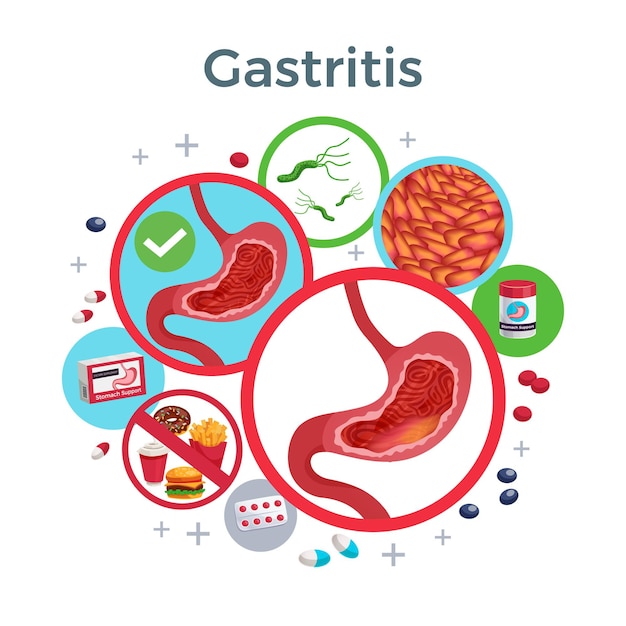 Los síntomas de la enfermedad de gastritis causan la composición plana de medicamentos circulares de alimentos saludables y afectados de bacterias estomacales