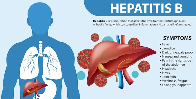 Vector gratuito síntomas de la hepatitis b infografía