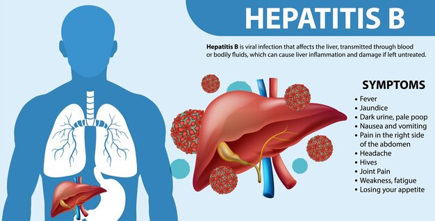 Síntomas de la Hepatitis B Infografía