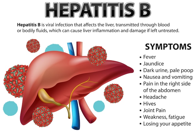 Vector gratuito síntomas de la hepatitis b