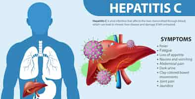 Vector gratuito síntomas informativos de la hepatitis c