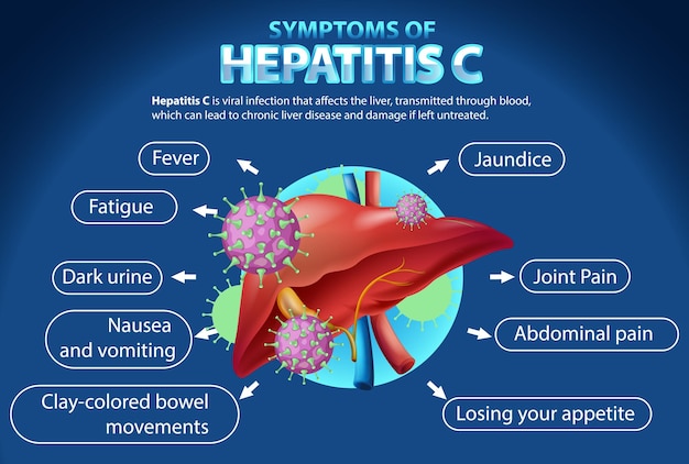 Síntomas informativos de la hepatitis c