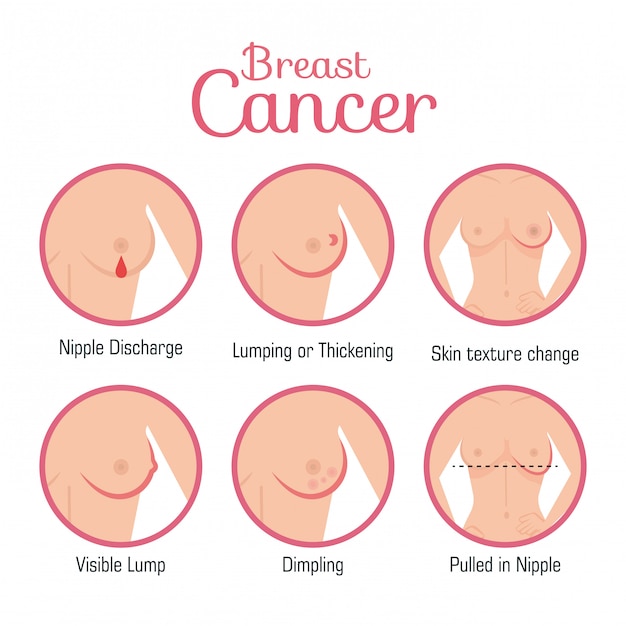 Tipos de apariencias del seno