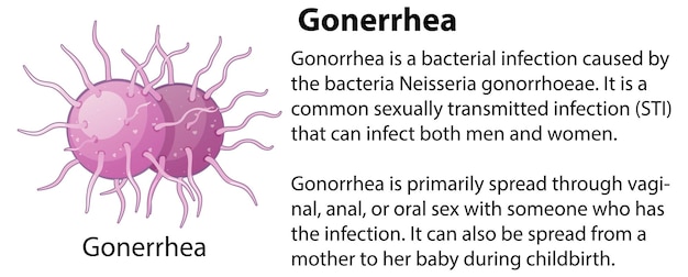 Vector gratuito virus de la gonorrea con explicación.