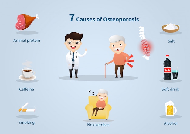 7 causa de la osteoporosis. personas mayores con problemas de osteoporosis.