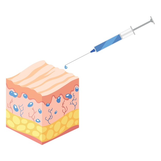 Ácido hialurónico isométrico Cubo de vista de perfil que representa las capas de la estructura de la piel icono del tejido subcutáneo dermis y estructura anatómica de la epidermis Ilustración vectorial de dibujos animados aislada en blanco