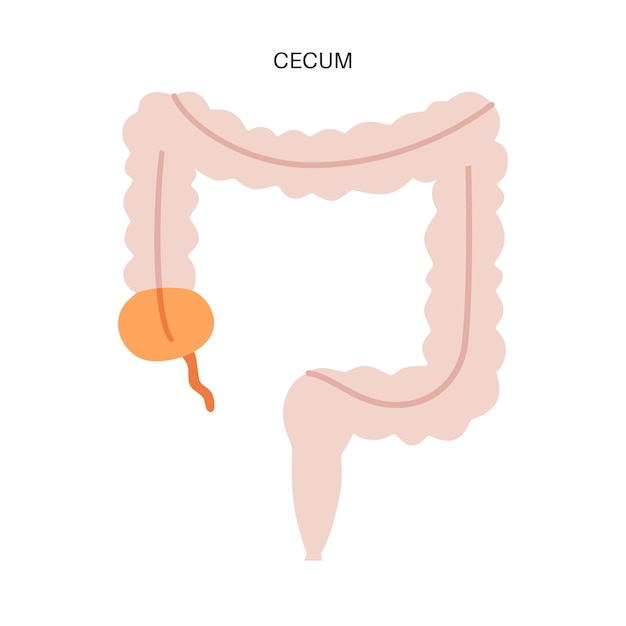 Vector afiche anatómico del intestino grueso cecum y apéndice parte del intestino humano examen del tracto digestivo en clínica de gastroenterología infografía del colon para educación ilustración vectorial aislada