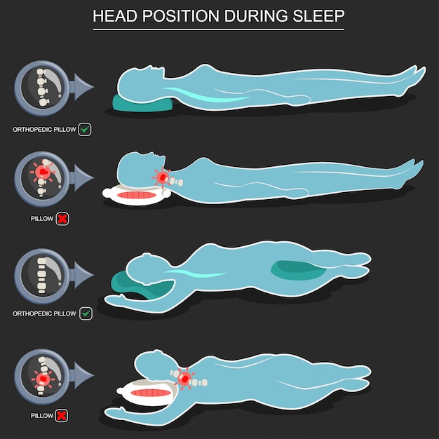 Almohadas ortopédicas para la correcta posición de la cabeza durante el sueño.