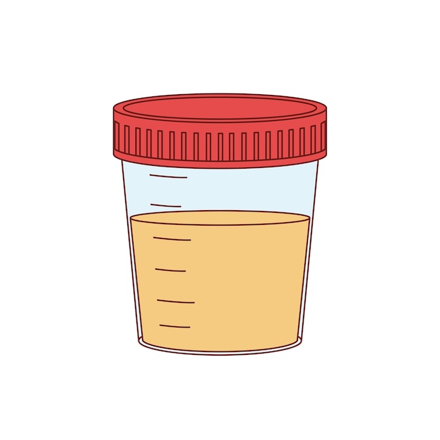 Análisis médico Análisis de laboratorio de orina en frascos de plástico Ilustración vectorial al estilo de dibujos animados
