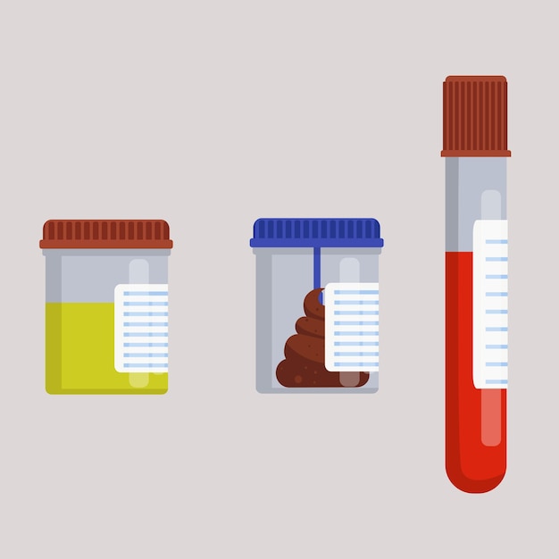 Vector análisis de orina y análisis de sangre