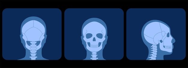 Vector anatomía del cráneo humano en la parte delantera, el perfil y la espalda en la ilustración de vector de vista de rayos x