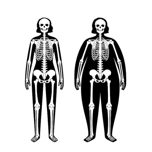 Vector anatomía del esqueleto obeso