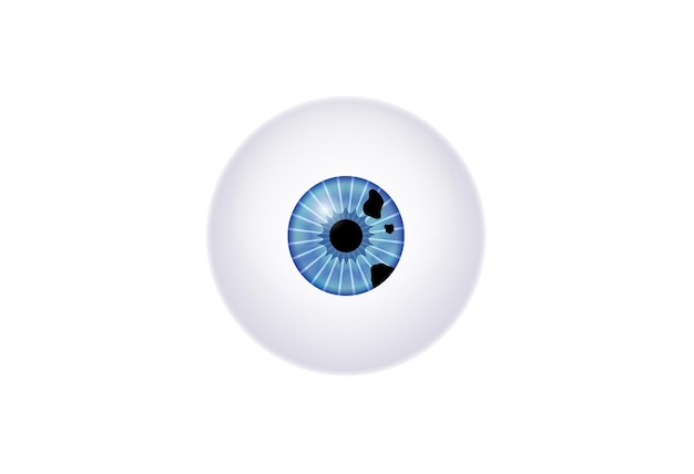 Anatomía del melanoma del iris