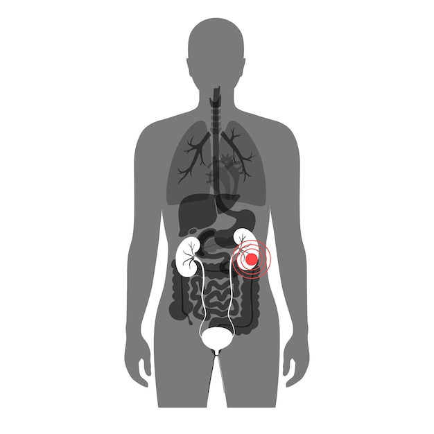 Anatomía del riñón en la ilustración aislada del vector plano médico del cuerpo masculino. Silueta hombre