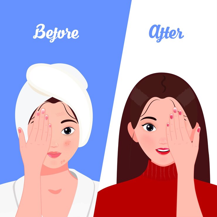 Antes y después del cuidado de la piel componen la ilustración vectorial