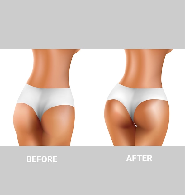 Vector antes y después del ejercicio de glúteos sexy