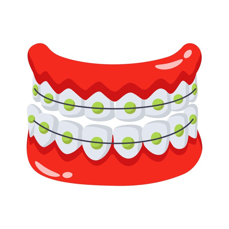 Vector aparatos dentales para la alineación de los dientes y el tratamiento ortodóncio