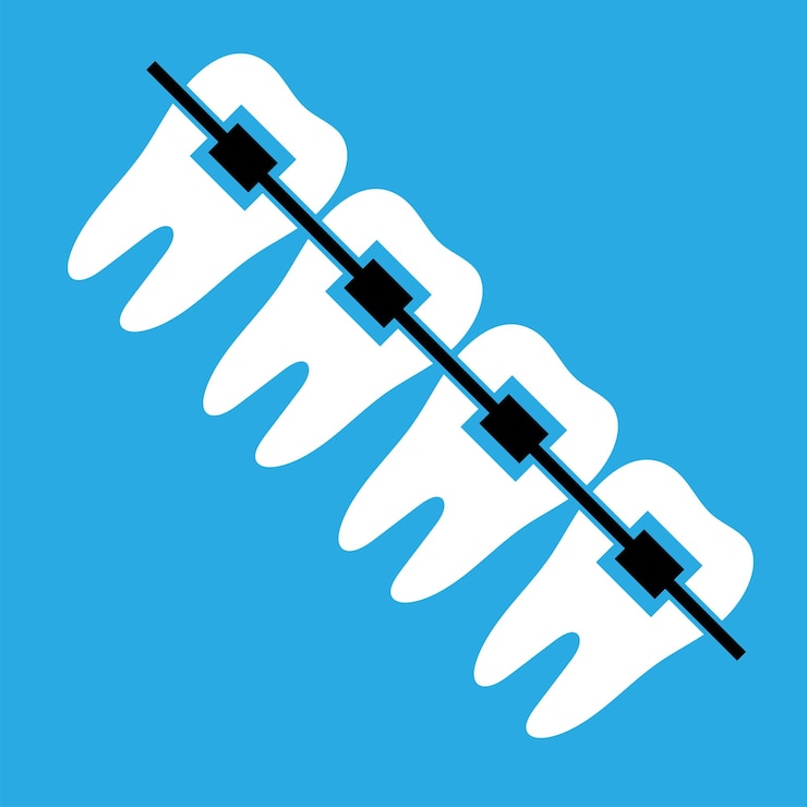 Vector aparatos dentales. incluso dientes blancos y sanos con frenillos. icono de plano sobre un fondo azul