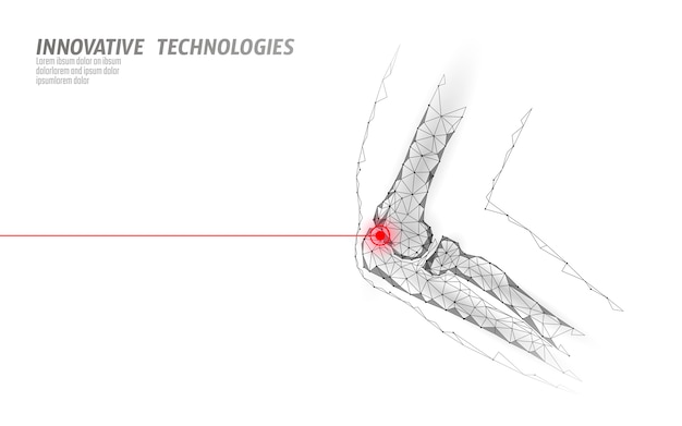 Vector articulación del codo humano 3d modelo ilustración vectorial. diseño de poli baja tecnología de futuro cura el tratamiento del dolor.