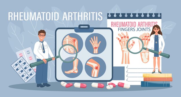 Artritis reumatoide para la página de inicio Tratamiento de la artritis Los médicos muestran enfermedades del sistema esquelético