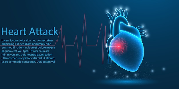 Vector ataque al corazón humano, concepto de baja poli.