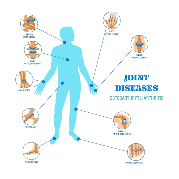 Banner infográfico de enfermedades de las articulaciones.