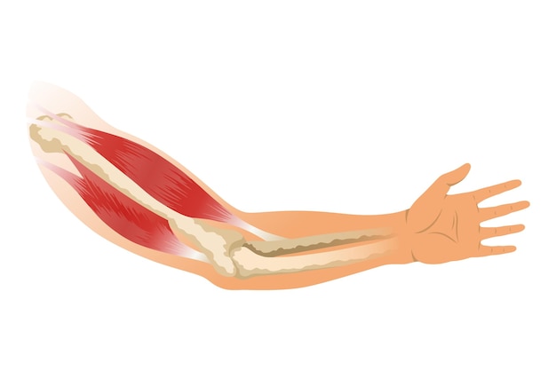 Brazo músculo bíceps con esqueleto Tensión muscular de mano humana sobre fondo blanco Huesos y articulaciones en silueta masculina Ilustración de vector médico de mano para clínica u hospital