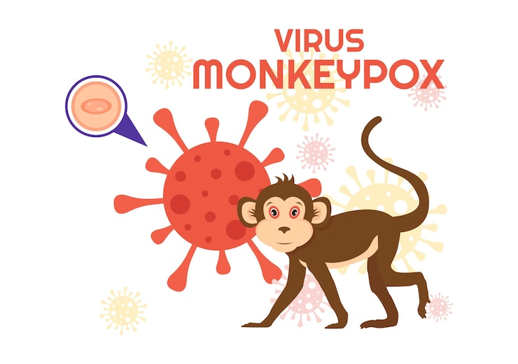 Vector brote de viruela del mono ilustración vectorial de los síntomas del virus en humanos microbiología de la viruela del mono