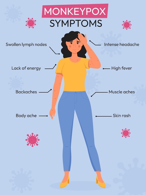 Brote de viruela del mono infografía de síntomas del virus de la viruela del mono