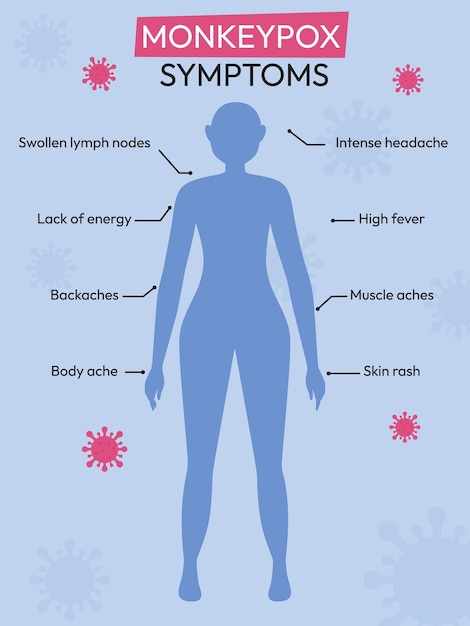 Brote de viruela del mono Síntomas del virus de la viruela del mono infografía Ilustración vectorial plana