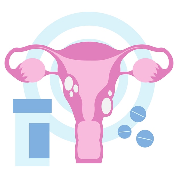 cáncer de cuello uterino de ovarios en ilustración plana