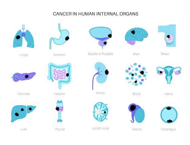 Cáncer en órganos internos. Logotipo de la clínica de oncología. Tumor en el cuerpo humano.