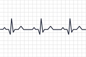 Vector cardiograma de enfermedad cardíaca. línea de latidos. cardiograma. electrocardiograma. monitor de pulso cardíaco con señal
