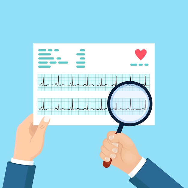 Cardiograma y lupas en la mano del médico. gráfico de ritmo cardíaco