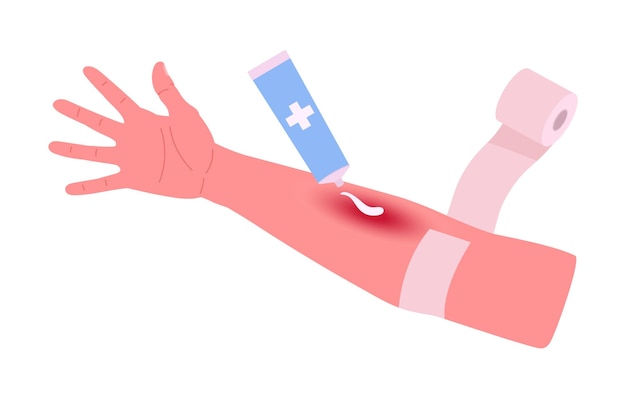 Caricatura de mano herida Primeros auxilios para quemaduras en la piel del cuerpo Tratamiento médico para lesiones en el brazo Ilustración de vector plano Mano humana herida y tratamiento médico