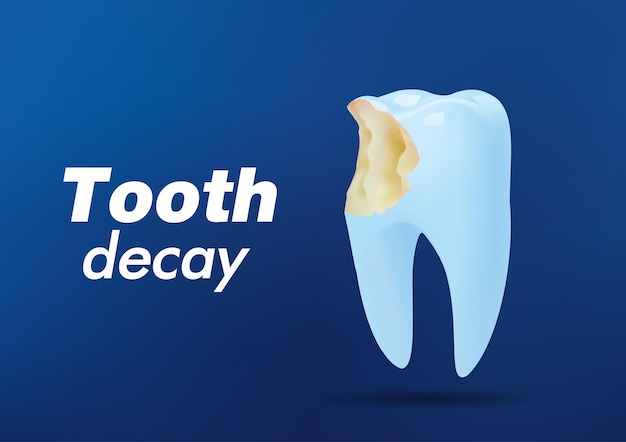 Vector caries dental mal diente fondo de cuidado dental dientes no saludables estomatología cuidado de los dientes