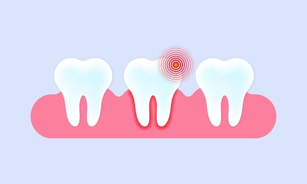 Caries y dolor de muelas