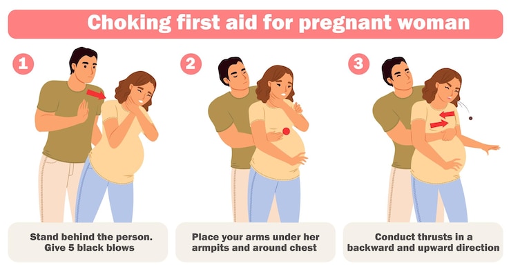 Vector cartel infográfico de formación en primeros auxilios para mujeres embarazadas en caso de asfixia