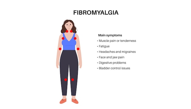 Vector cartel médico para la fibromialgia