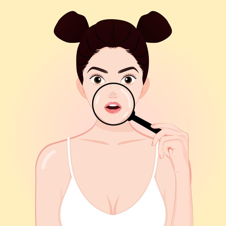 Chica sosteniendo una lupa con problemas de piel cabezas negras cuidado de la piel tratamiento facial belleza