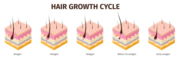 Vector ciclo de crecimiento del folículo piloso isométrico pasos infografía anatomía de la piel cartel médico crecimiento del cabello anágeno telógeno fases catágenas conjunto de vectores
