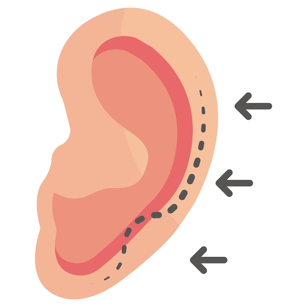 cirugía estética del oído o concepto de Macrotia oídos cartílago externo remodelación de diseño vectorial cosméticos