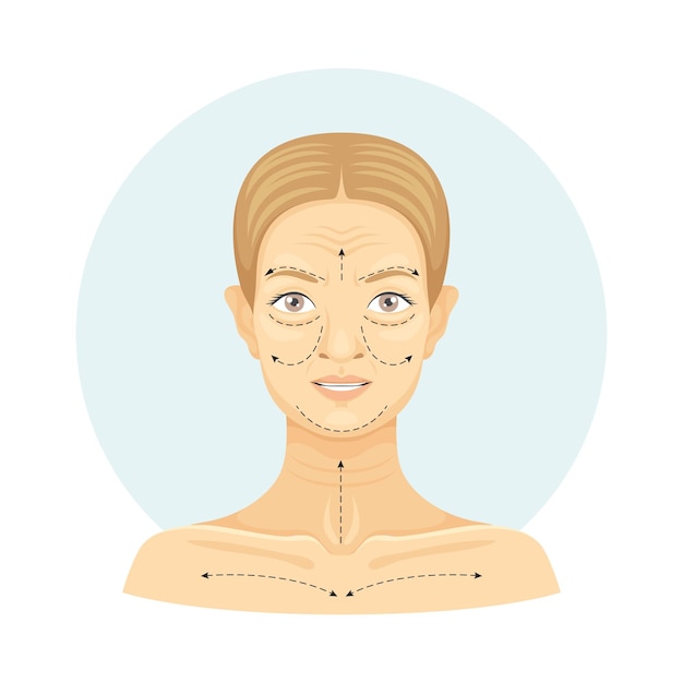 Cirugía estética en el rostro femenino con líneas punteadas Ilustración vectorial de cirugía plástica