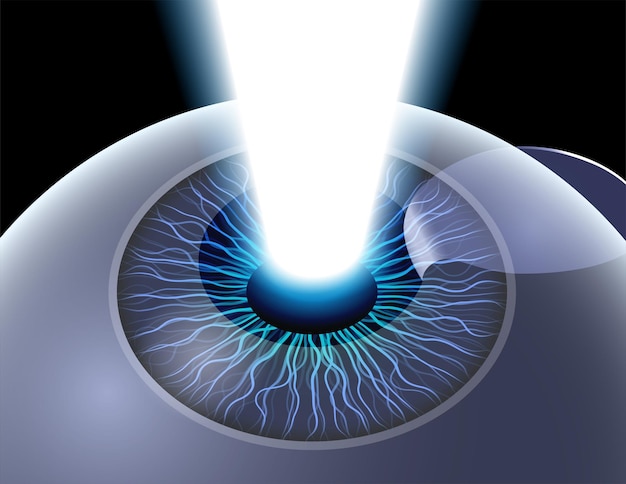 Cirugía ocular LASIK