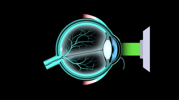Cirugía ocular LASIK