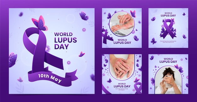 Vector colección de publicaciones de instagram para el día mundial del lupus