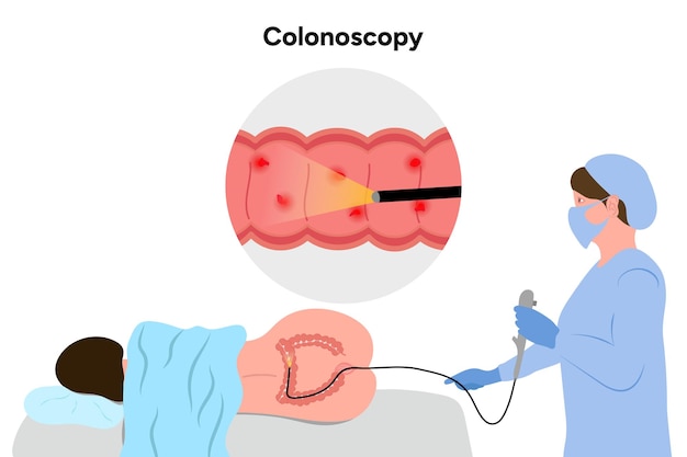 Colonoscopia y colonoscopio
