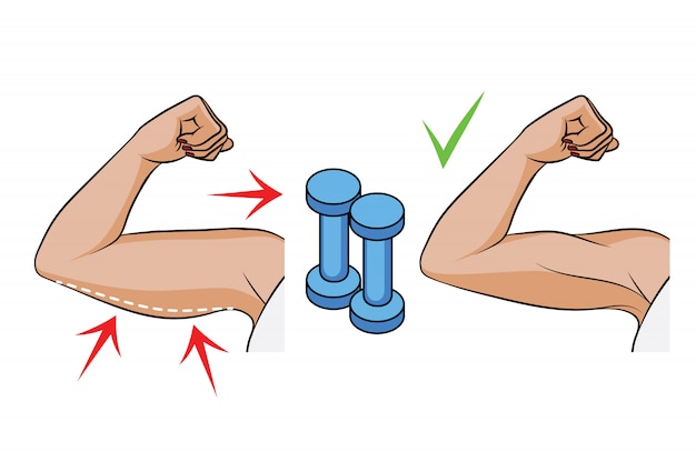 Color ilustración vectorial de un problema de sobrepeso en las mujeres. vista lateral de manos femeninas. grasa corporal en tríceps femeninos. antes y después de los ejercicios con mancuernas